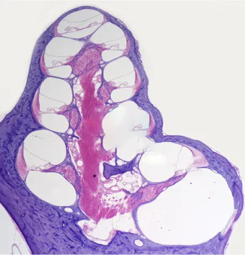 Illustration: The Inner Ear