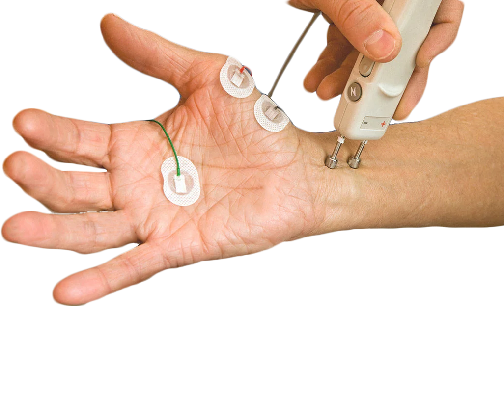 Nerve conduction testing on the hand and wrist