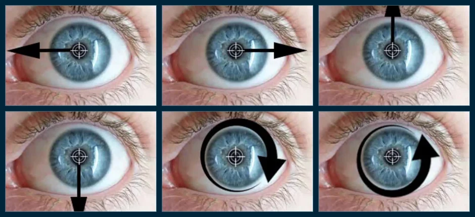 Six annotated frames from the library: right-beating, left-beating, upbeat, downbeat, clockwise torsional and counterclockwise torsional nystagmus