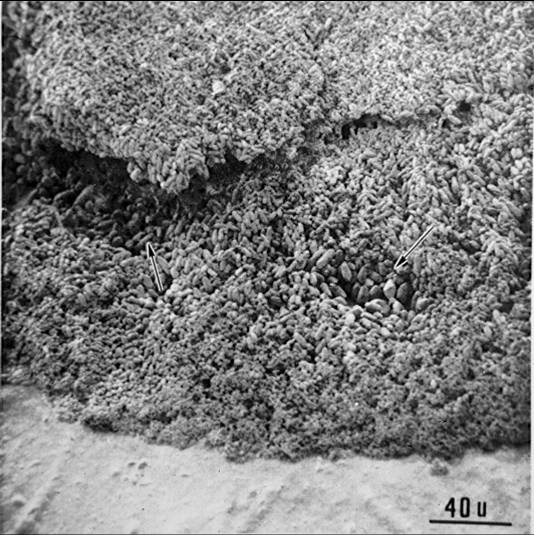 Another microscopic close-up of otoconia, highlighting the detailed structure of these crystals and their role in the vestibular system.