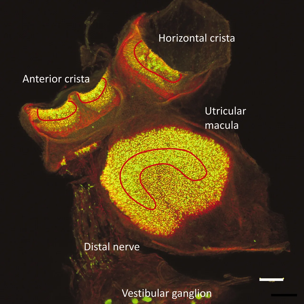 A labeled microscopic image of the utricle, highlighting the densely packed sensory hair cells that detect vertical accelerations and contribute to the sense of balance.